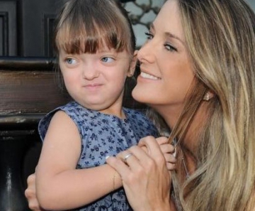 Rafaella justus sindrome de deals apert