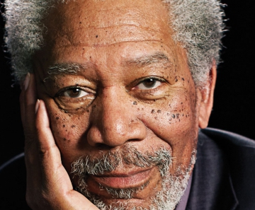 Dermatose Papulosa Nigra: o ator Morgan Freeman sofre dessa doença. - Foto: Reprodução